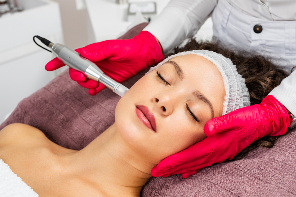 PRP with Microneedling