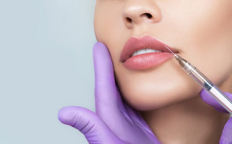 How Long Do Lip Fillers Last After Perfectly Plumping?