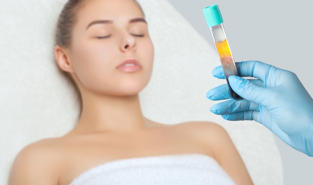 PRP for facial rejuvenation