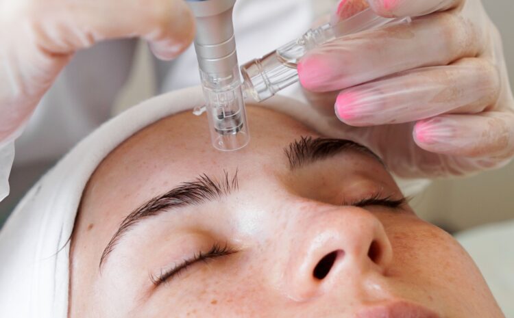 Best Microneedling in Vienna, VA