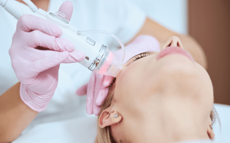 Best Microneedling in Vienna, VA