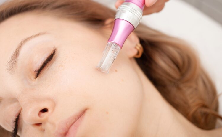  Microneedling Specialist Near Virginia