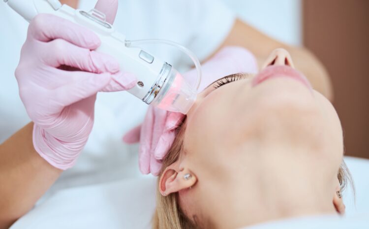 Microneedling Specials in Vienna, VA