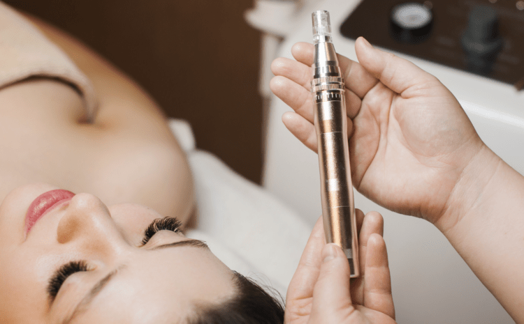 How Much Is RF Microneedling in Vienna, Virginia?