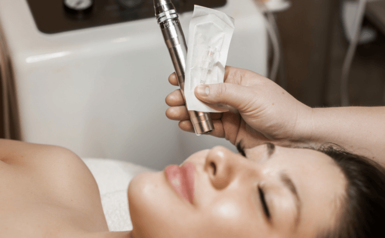  Best Microneedling Treatment in Tysons Corner