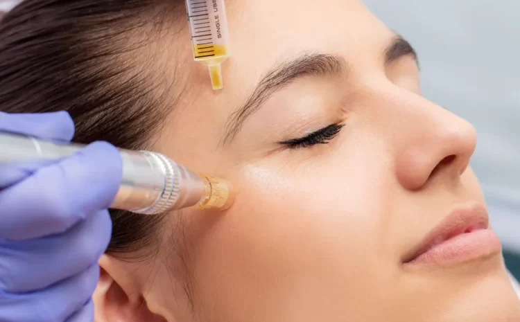 Rejuvenate Your Skin with PRP + Microneedling at The Feisee Institute