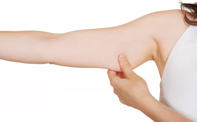 Get Sleek, Sculpted Arms with Barbie Arm Botox and Arm Filler!