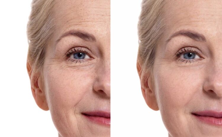  PRP vs PRF: What’s the Difference and Which One Is Right for You?